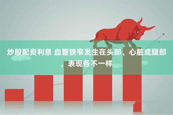 炒股配资利息 血管狭窄发生在头部、心脏或腿部，表现各不一样
